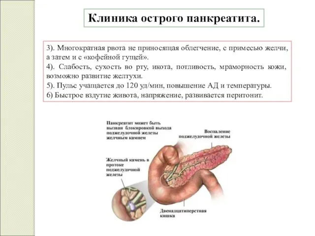 3). Многократная рвота не приносящая облегчение, с примесью желчи, а затем