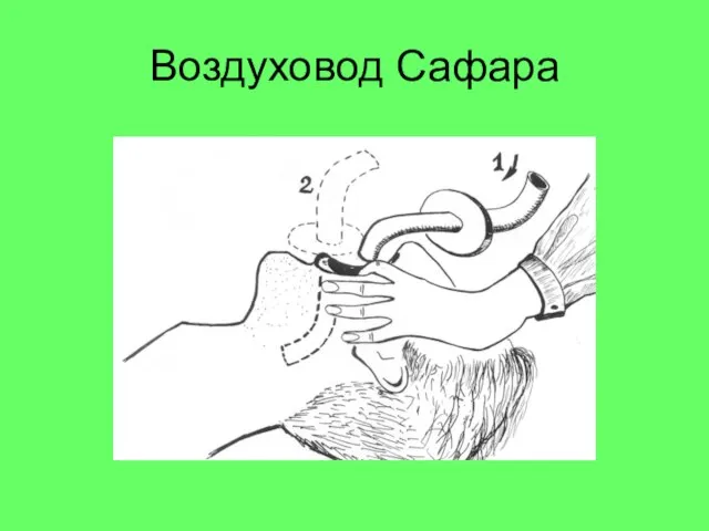 Воздуховод Сафара