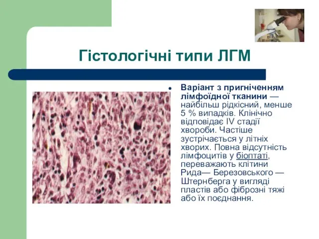 Гістологічні типи ЛГМ Варіант з пригніченням лімфоїдної тканини — найбільш рідкісний,