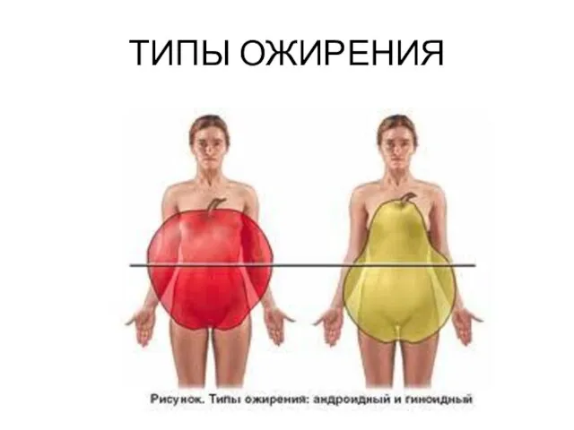 ТИПЫ ОЖИРЕНИЯ