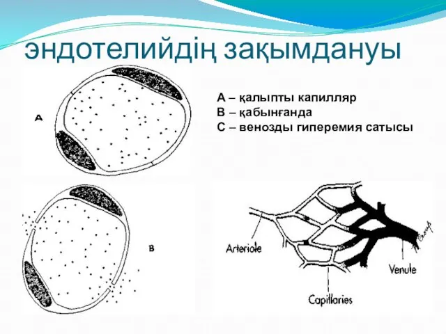 эндотелийдің зақымдануы A – қалыпты капилляр В – қабынғанда С – венозды гиперемия сатысы