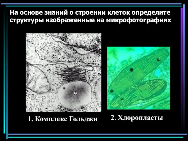 На основе знаний о строении клеток определите структуры изображенные на микрофотографиях 1. Комплекс Гольджи 2. Хлоропласты