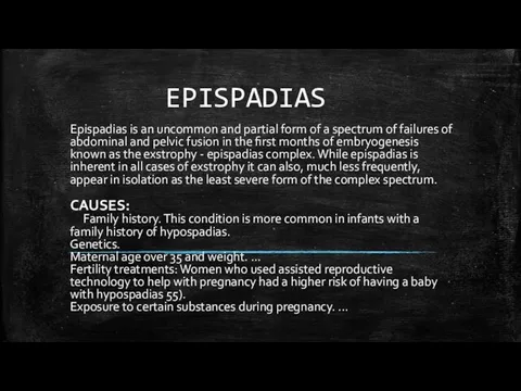 EPISPADIAS Epispadias is an uncommon and partial form of a spectrum