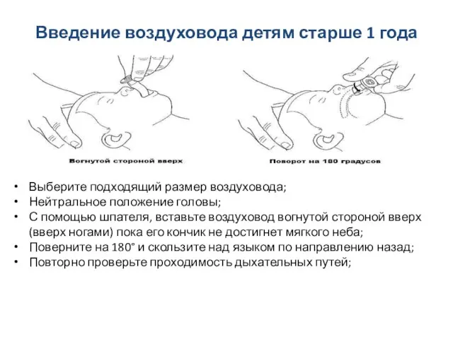 Введение воздуховода детям старше 1 года Выберите подходящий размер воздуховода; Нейтральное