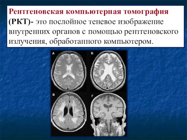 Рентгеновская компьютерная томография (РКТ)- это послойное теневое изображение внутренних органов с помощью рентгеновского излучения, обработанного компьютером.