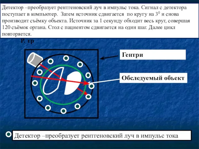 Р. тр Детектор –преобразует рентгеновский луч в импульс тока Гентри Обследуемый