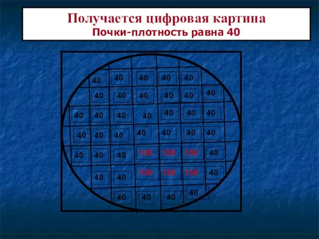 40 Получается цифровая картина Почки-плотность равна 40