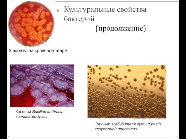 S.аureus на кровяном агаре Колонии Bacillus anthracis «голова медузы» Колонии возбудителя