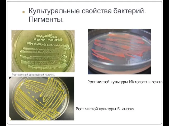 Культуральные свойства бактерий. Пигменты. Рост чистой культуры Micrococcus roseus. Рост чистой культуры S. aureus