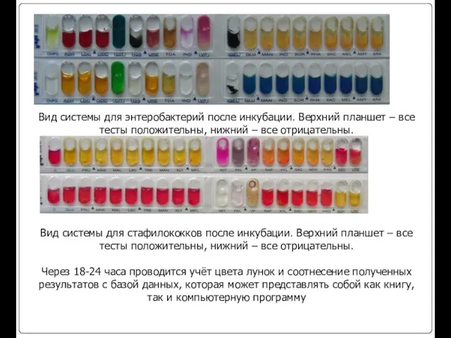 Вид системы для энтеробактерий после инкубации. Верхний планшет – все тесты