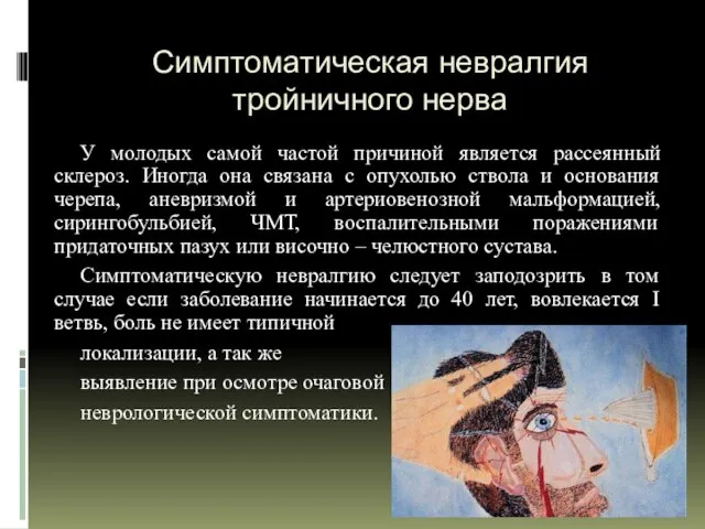 08/04/2023 Смагина И.В. Симптоматическая невралгия тройничного нерва У молодых самой частой