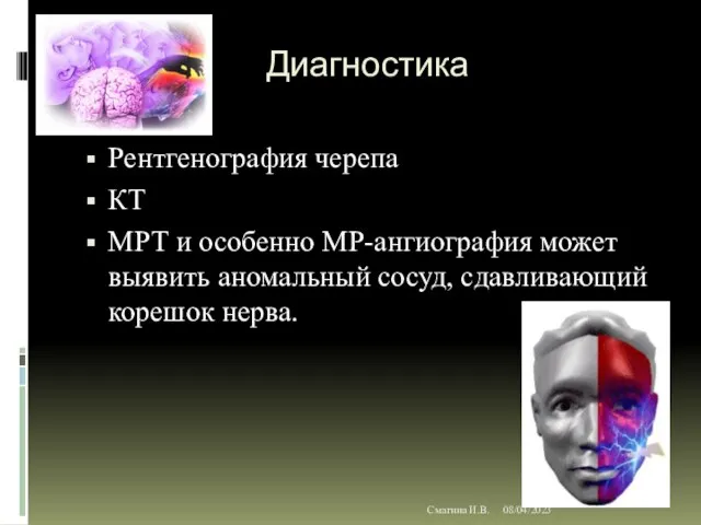 08/04/2023 Смагина И.В. Диагностика Рентгенография черепа КТ МРТ и особенно МР-ангиография