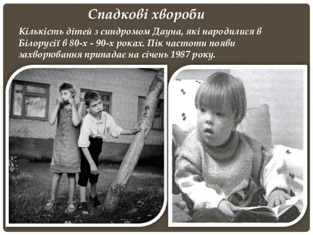 Спадкові хвороби Кількість дітей з синдромом Дауна, які народилися в Білорусії