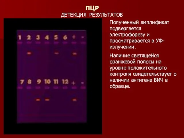 Полученный амплификат подвергается электрофорезу и просматривается в УФ-излучении. Наличие светящейся оранжевой