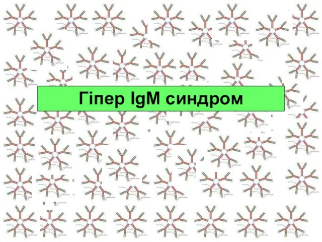 Гіпер IgM синдром