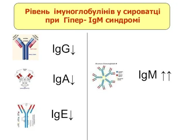 IgG↓ IgE↓ IgA↓ IgM ↑↑ Рівень імуноглобулінів у сироватці при Гіпер- IgM синдромі