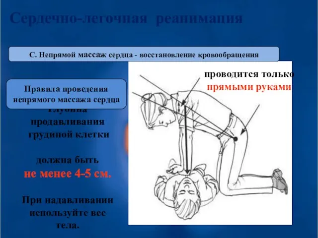 Сердечно-легочная реанимация Глубина продавливания грудиной клетки должна быть не менее 4-5