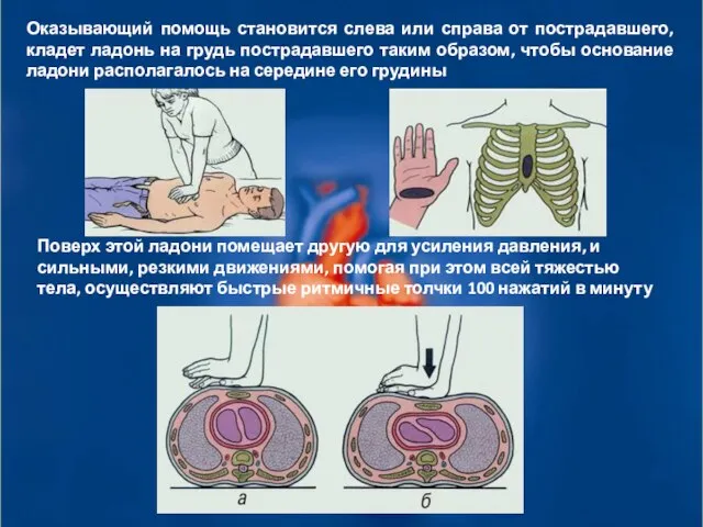 Оказывающий помощь становится слева или справа от пострадавшего, кладет ладонь на