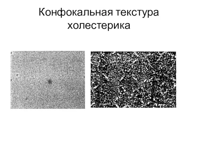 Конфокальная текстура холестерика