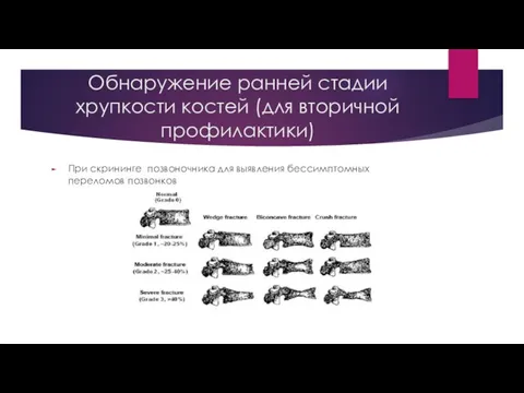 Обнаружение ранней стадии хрупкости костей (для вторичной профилактики) При скрининге позвоночника для выявления бессимптомных переломов позвонков