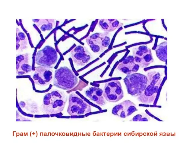 Грам (+) палочковидные бактерии сибирской язвы