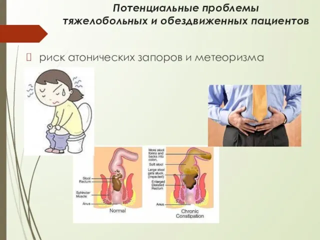 Потенциальные проблемы тяжелобольных и обездвиженных пациентов риск атонических запоров и метеоризма