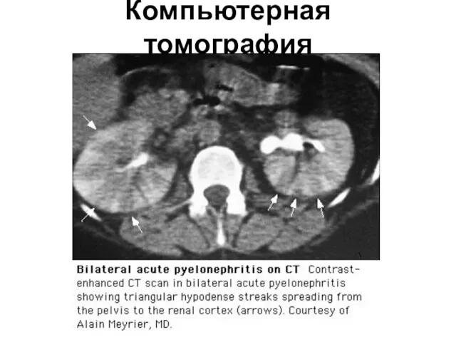 Компьютерная томография