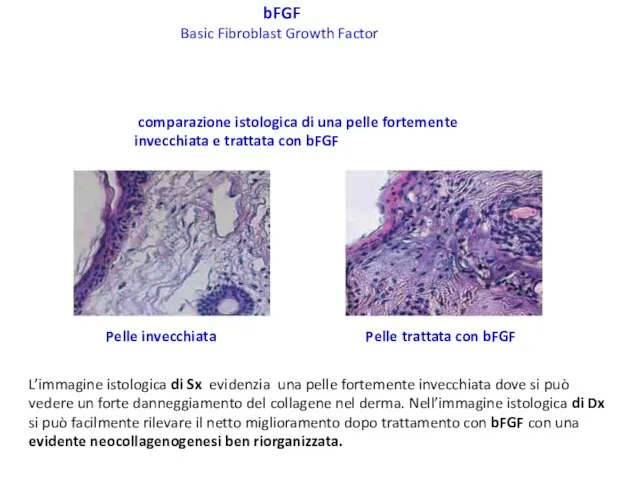 bFGF Basic Fibroblast Growth Factor L’immagine istologica di Sx evidenzia una