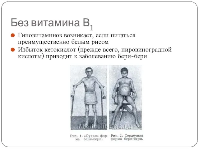 Без витамина В1 Гиповитаминоз возникает, если питаться преимущественно белым рисом Избыток