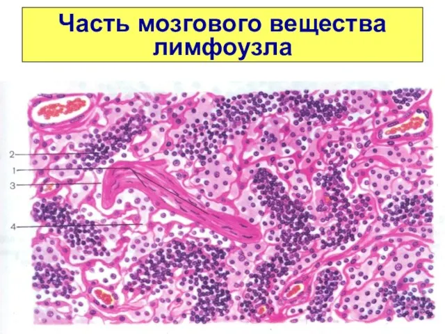 Часть мозгового вещества лимфоузла