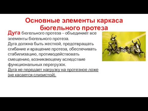 Основные элементы каркаса бюгельного протеза Дуга бюгельного протеза – объединяет все