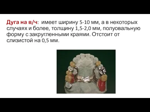 Дуга на в/ч: имеет ширину 5-10 мм, а в некоторых случаях