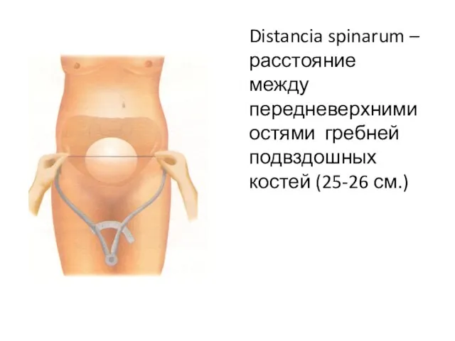 Distancia spinarum – расстояние между передневерхними остями гребней подвздошных костей (25-26 см.)