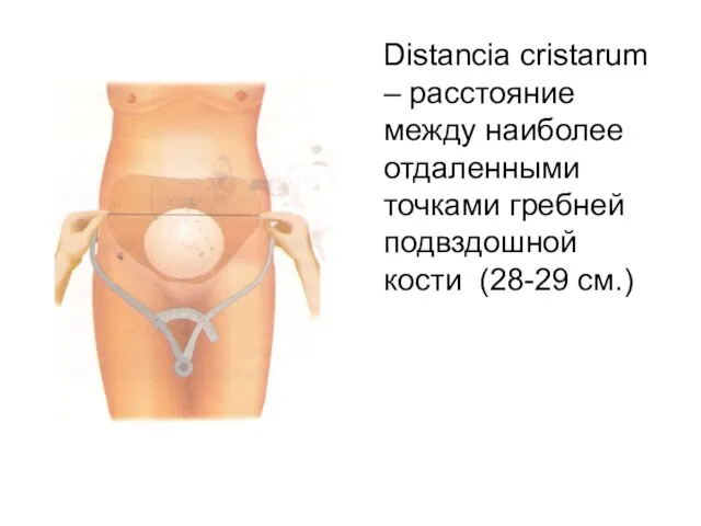 Distancia cristarum – расстояние между наиболее отдаленными точками гребней подвздошной кости (28-29 см.)