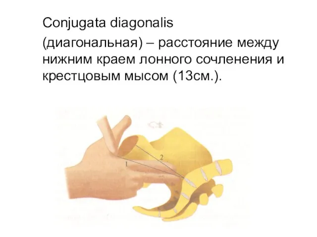 Conjugata diagonalis (диагональная) – расстояние между нижним краем лонного сочленения и крестцовым мысом (13см.).