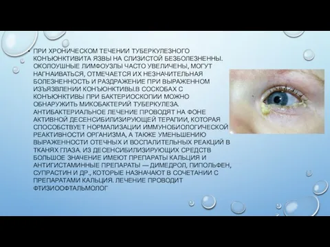 ПРИ ХРОНИЧЕСКОМ ТЕЧЕНИИ ТУБЕРКУЛЕЗНОГО КОНЪЮНКТИВИТА ЯЗВЫ НА СЛИЗИСТОЙ БЕЗБОЛЕЗНЕННЫ. ОКОЛОУШНЫЕ ЛИМФОУЗЛЫ