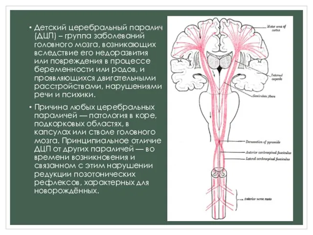 Детский церебральный паралич (ДЦП) – группа заболеваний головного мозга, возникающих вследствие