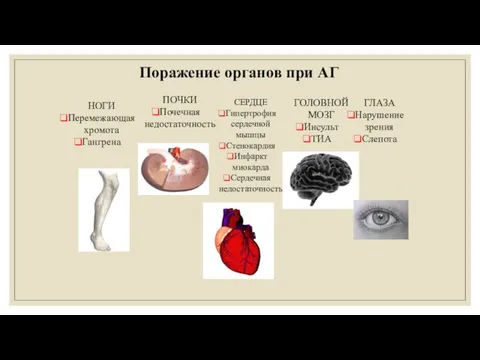 Поражение органов при АГ НОГИ Перемежающая хромота Гангрена ПОЧКИ Почечная недостаточность