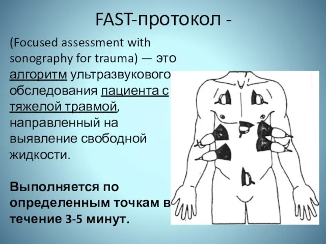 FAST-протокол - (Focused assessment with sonography for trauma) — это алгоритм