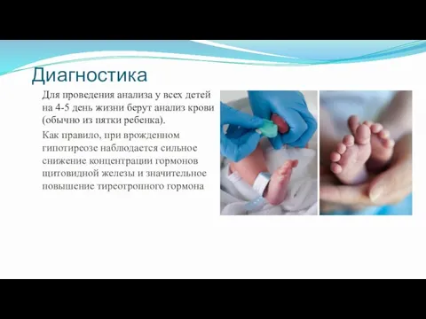 Диагностика Для проведения анализа у всех детей на 4-5 день жизни