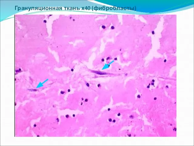 Грануляционная ткань х40 (фибробласты)