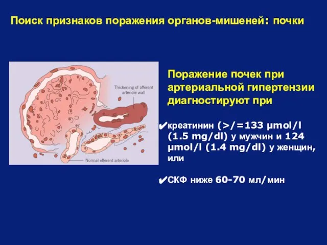 Поиск признаков поражения органов-мишеней: почки Поражение почек при артериальной гипертензии диагностируют