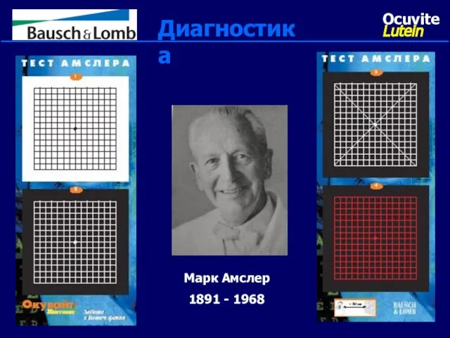 Марк Амслер 1891 - 1968 Диагностика