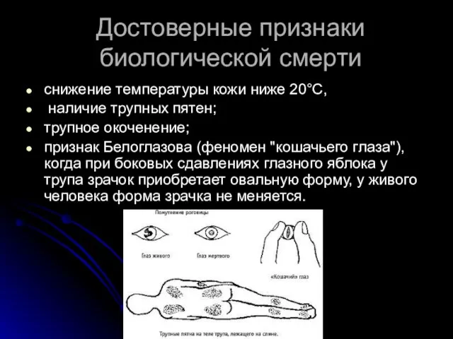 Достоверные признаки биологической смерти снижение температуры кожи ниже 20°С, наличие трупных