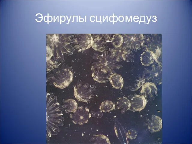 Эфирулы сцифомедуз