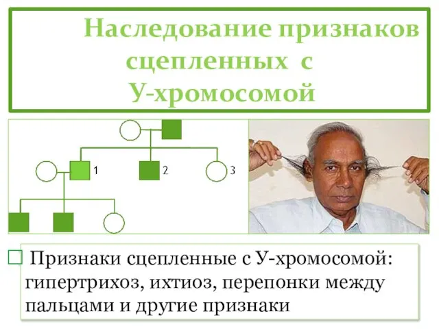 Наследование признаков сцепленных с У-хромосомой Признаки сцепленные с У-хромосомой: гипертрихоз, ихтиоз,