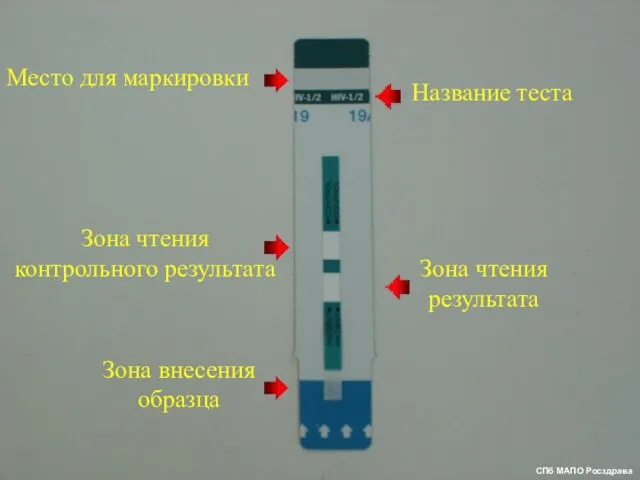 Место для маркировки Название теста Зона чтения контрольного результата Зона чтения