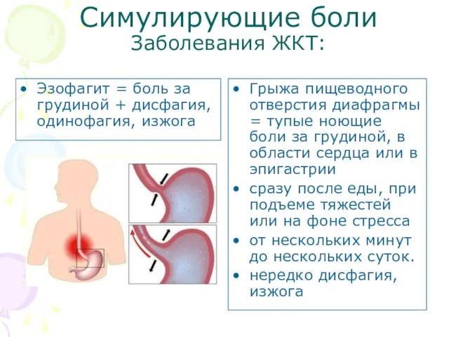 Симулирующие боли Заболевания ЖКТ: Эзофагит = боль за грудиной + дисфагия,