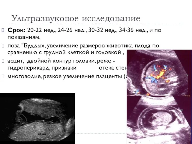 Ультразвуковое исследование Срок: 20-22 нед., 24-26 нед., 30-32 нед., 34-36 нед.,