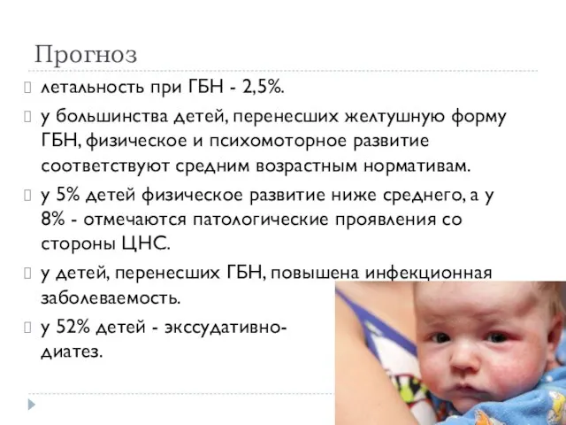 Прогноз летальность при ГБН - 2,5%. у большинства детей, перенесших желтушную